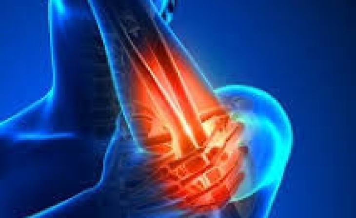 Σύνδρομο παγίδευσης κερκιδικού νεύρου